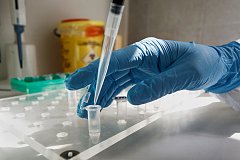 Стоит ли обращаться в частные лаборатории за анализом на коронавирус?