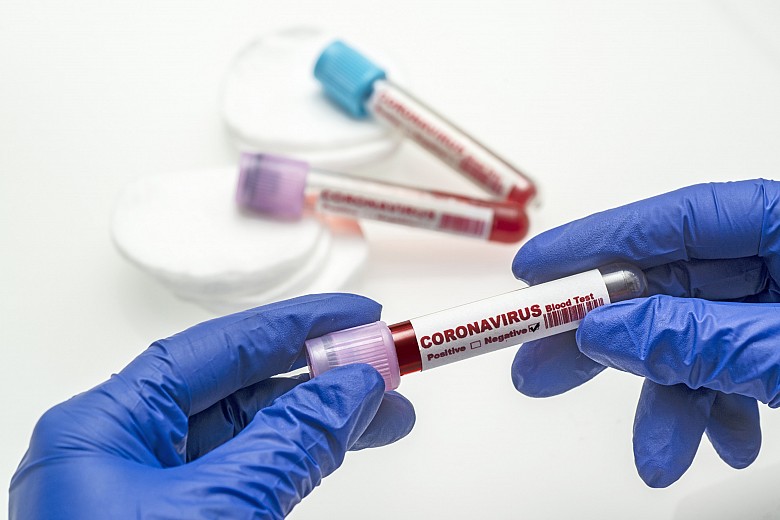 Быстрые тесты на коронавирус имеют низкую надежность и часто выдают ложные результаты
