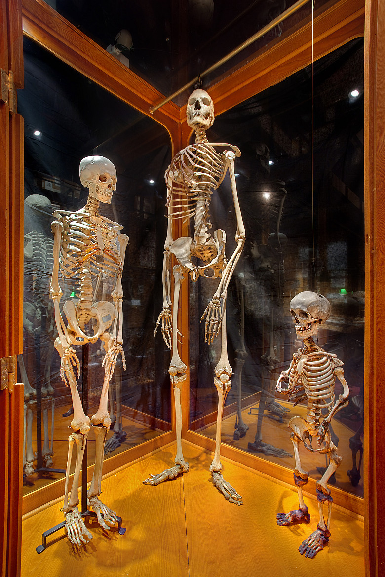 Музей черепов и скелетов со всевозможными патологиями. Пенсильвания.