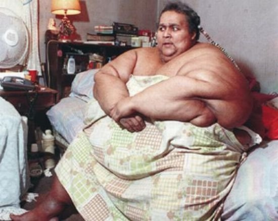 Вальтер Хадсон американец, вес - 540 кг, умер в 50 лет