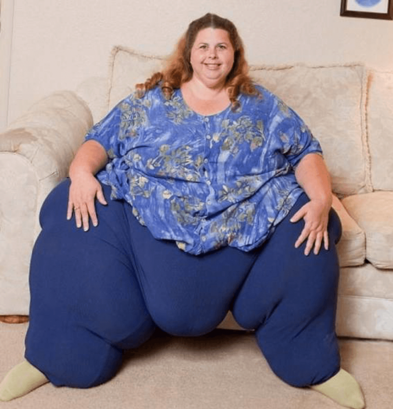 Кэрол Ягер, рост 170 см., вес – 597 кг, умерла в 43 года
