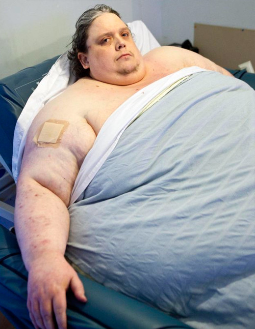 британец Кит Мартин, вес 444 кг, умер в 44 года