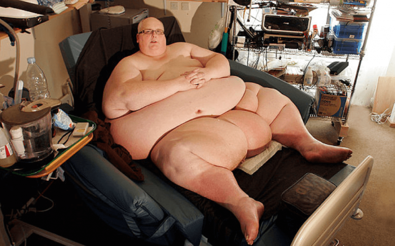 Пол Мейсон, вес – 445 кг, Жив, похудел на 305 кг.