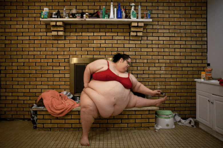 Донна Симпсон, вес - 290 кг. Жива, похудела на 170 кг.